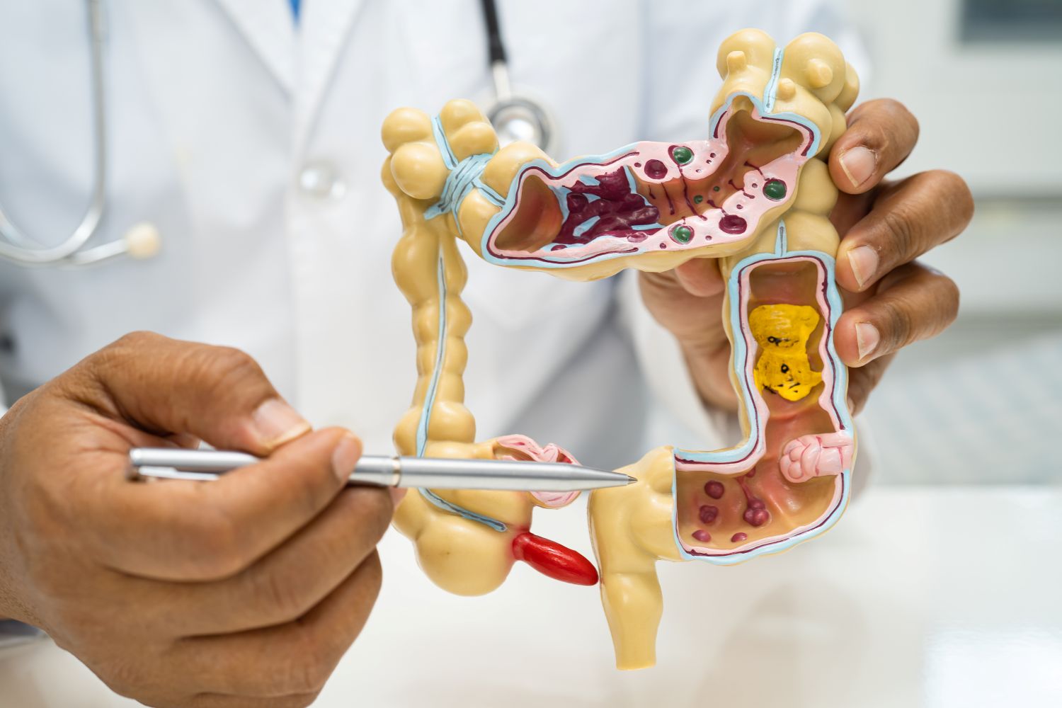 Appendicitis